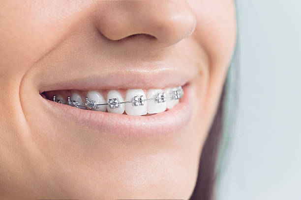 Why Choose Us for Your Dental Needs in Apple Valley, CA